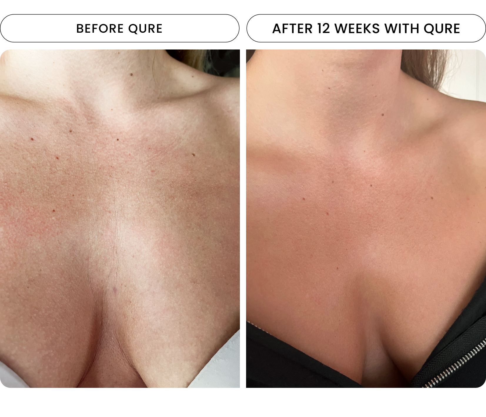 neck result two