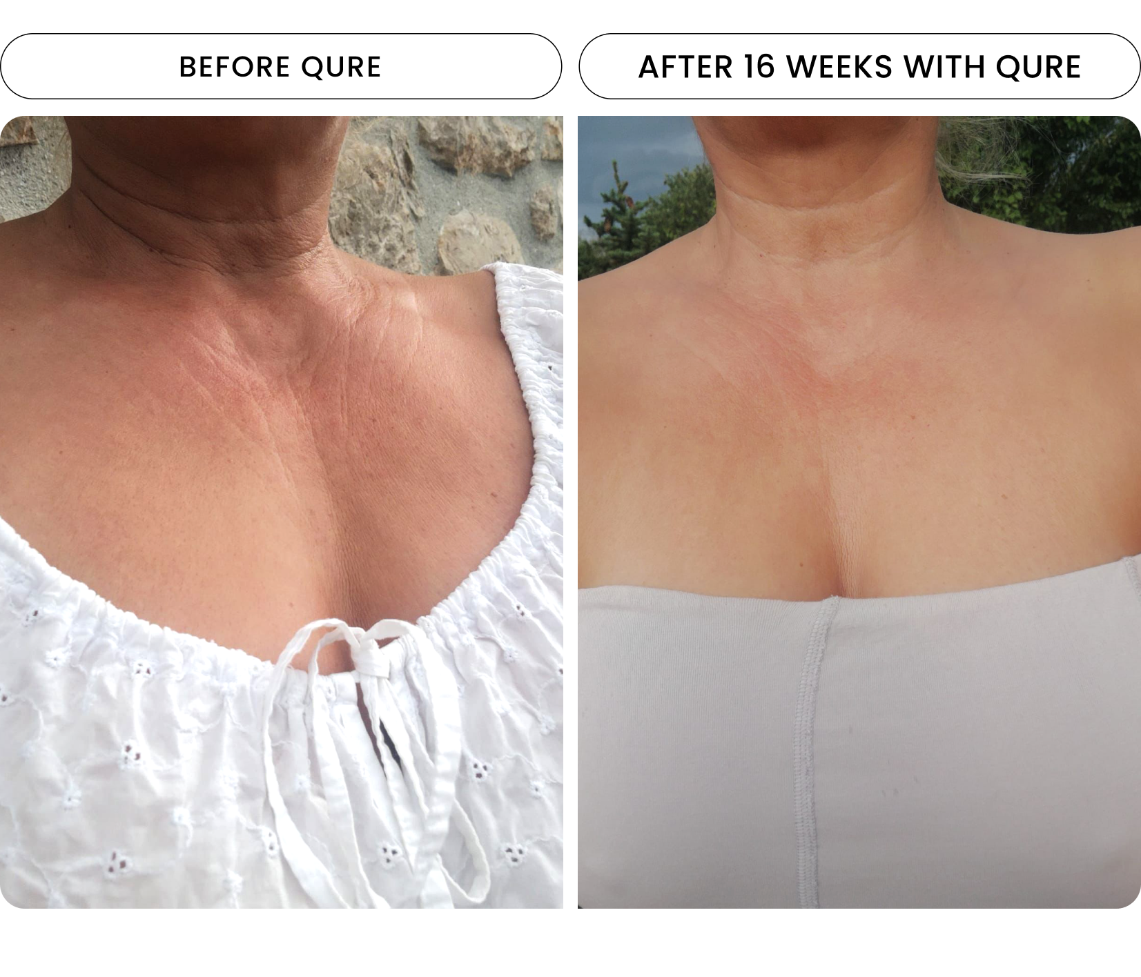 neck result one